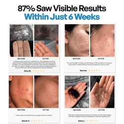 Collagen 3 Month Supply (750g)