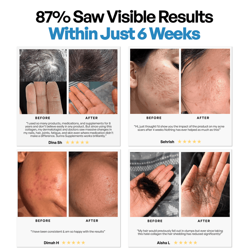 Collagen 3 Month Supply (750g)